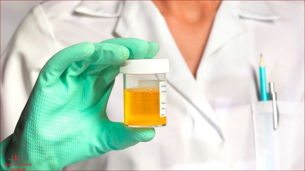 Comment collecter les urines de mon bébé pour un ECBU